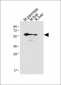 USP30 Antibody (N-term)
